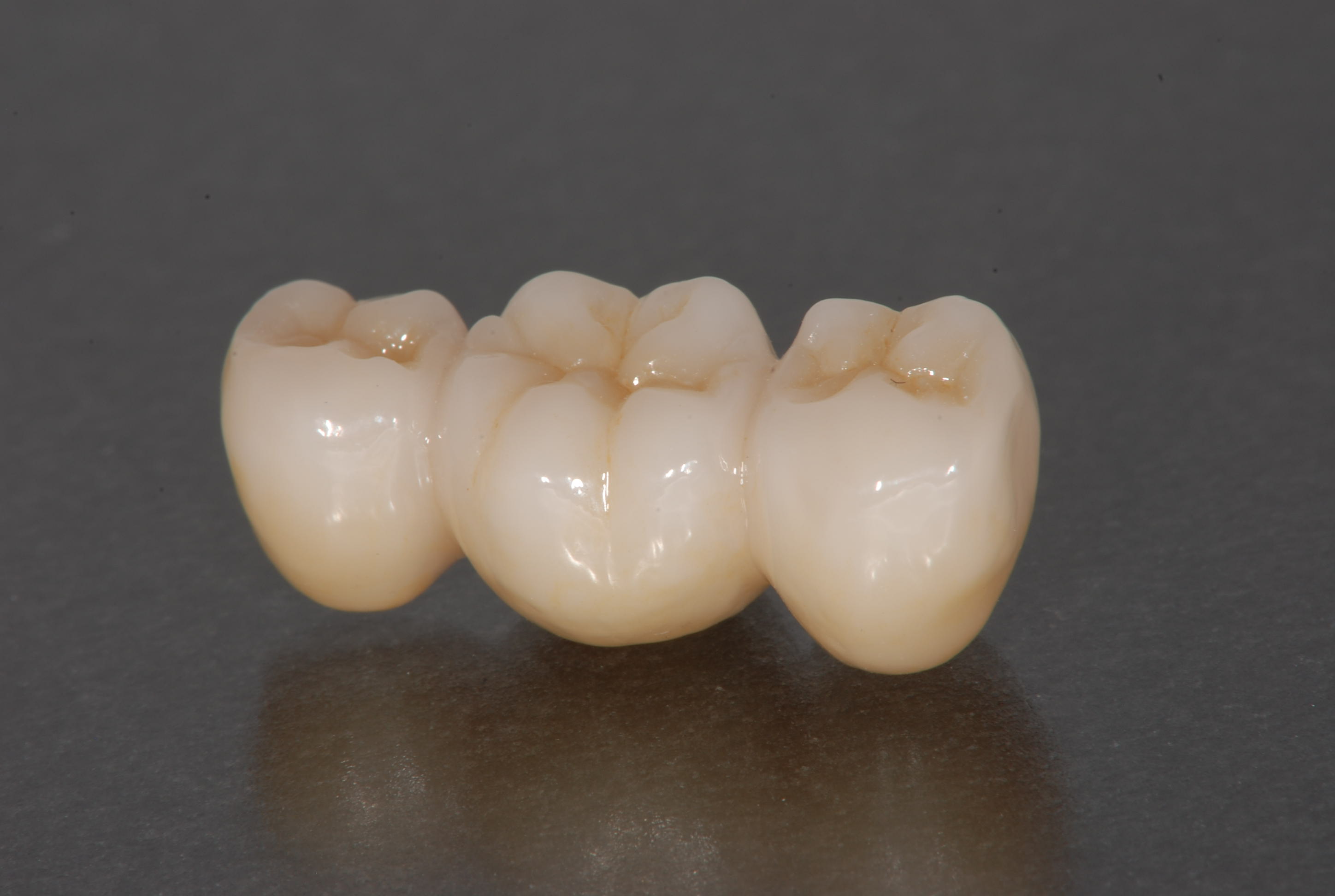 フルジルコニアクラウン - 歯科技工所 株式会社ファインデンタル