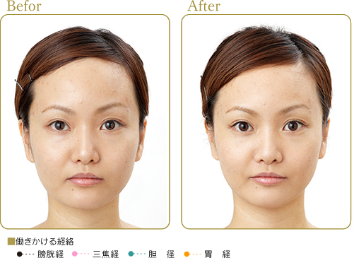 株式会社 リード モンテセラピー 製品のご案内＜リフトターバン＞