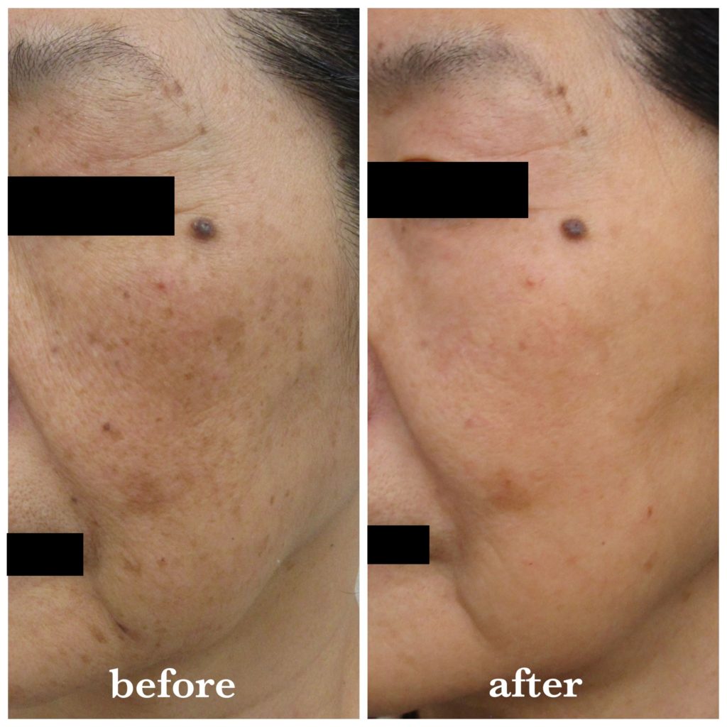 df2e63c77e7b4167357d7c4ed7216d