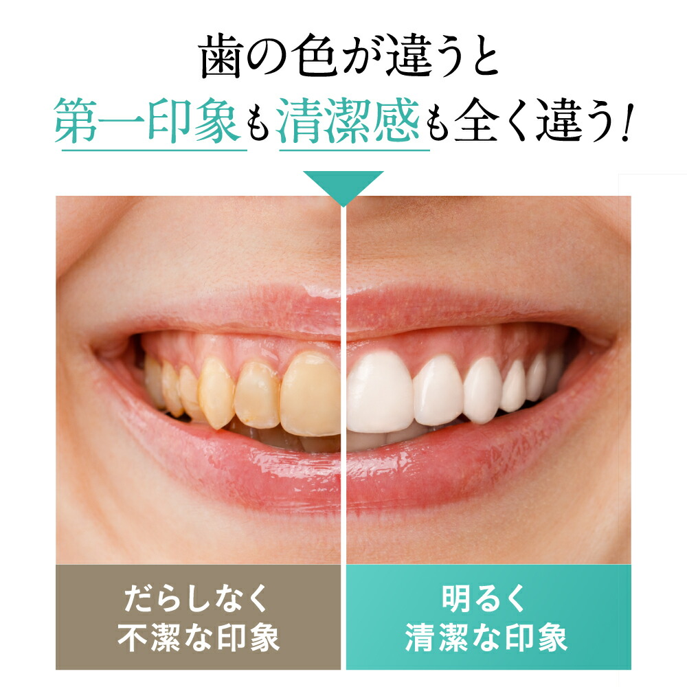 楽天市場】□P10倍＆クーポン配布(定期便除く)□【ホワイトニング