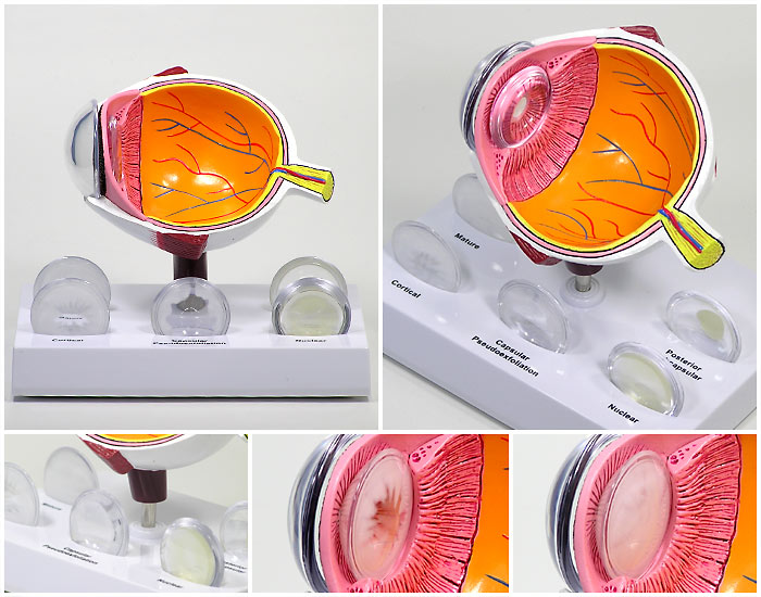 楽天市場】人体模型 眼球 白内障 モデル OM-GP-2800 GPI Anatomicals
