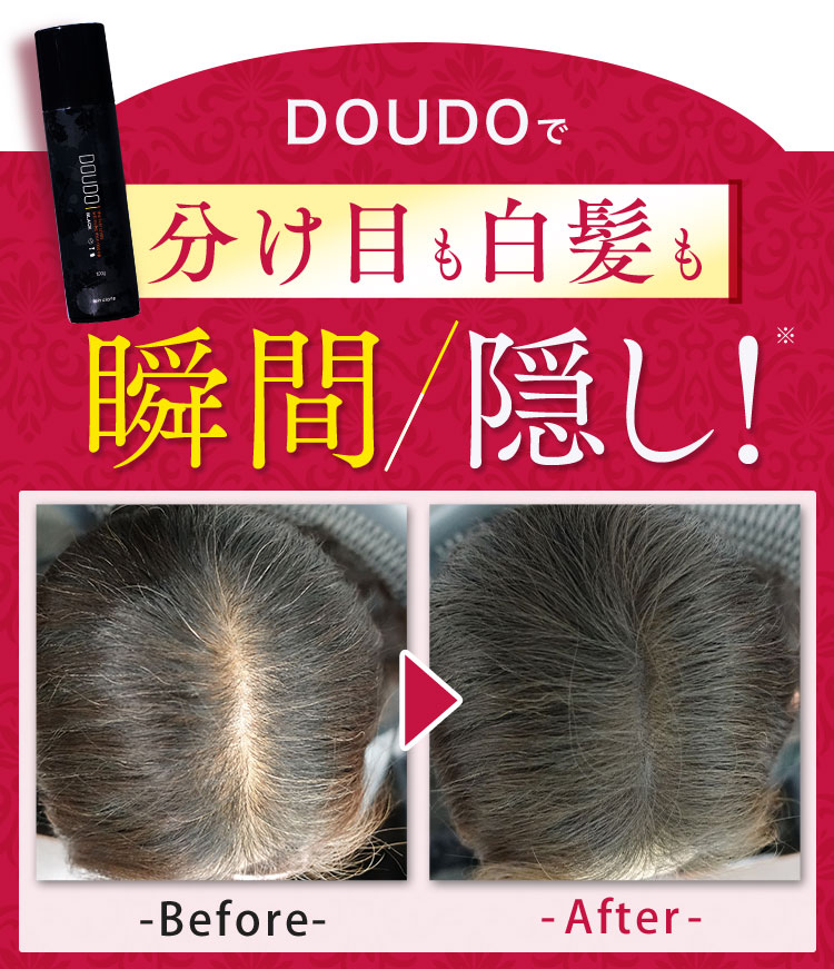 楽天市場】薄毛隠し 増毛スプレー【DOUDO ドウド 100g】ボリューム