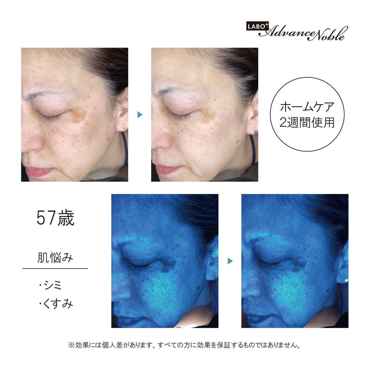 ラボプラス ADノーブル アルティメットセットWH【店販用】の卸・通販