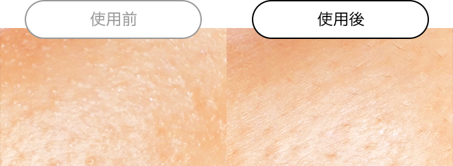 クエスク メディックス EXシリーズ | スキンケア化粧品・サイエンス