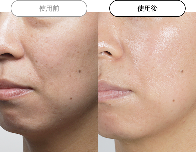 クエスク メディックス EXシリーズ | スキンケア化粧品・サイエンス