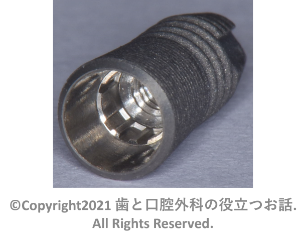Astra Tech Implant OsseoSpeed EV Conicalについて | 歯と口腔外科の