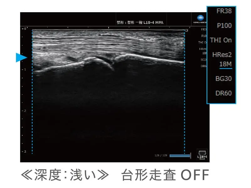超音波診断装置 SONIMAGE HS2 | コニカミノルタ