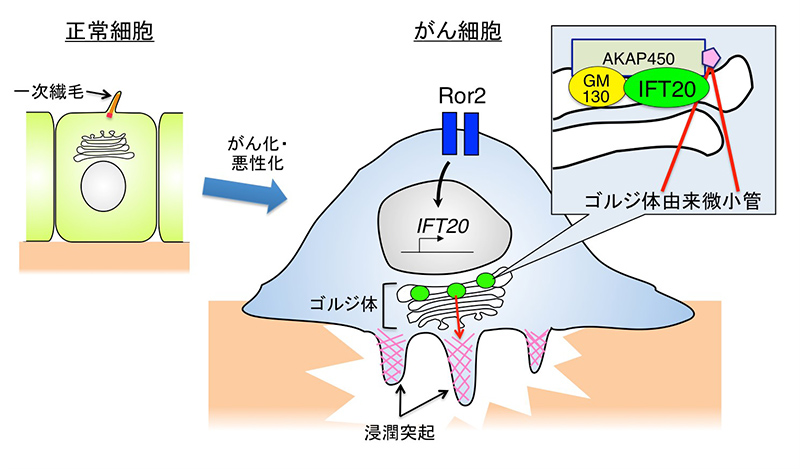 がん細胞での細胞内タンパク質「IFT20」の働きを解明 | 神戸大学