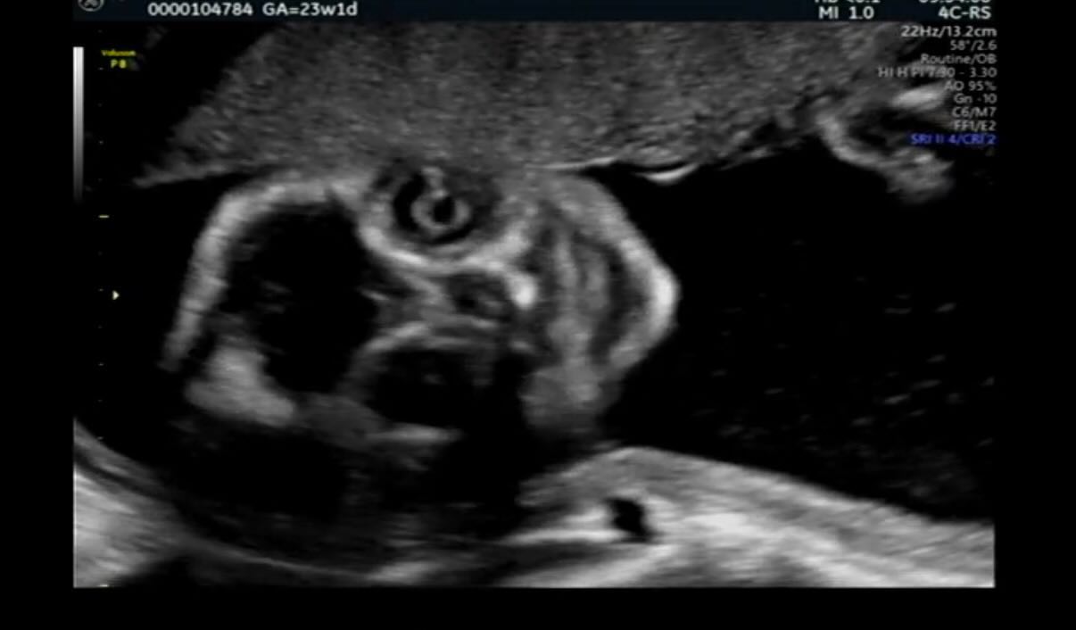 妊娠し、エコーを撮ると…母「！？」まさかの姿に「優勝です」「夢に出