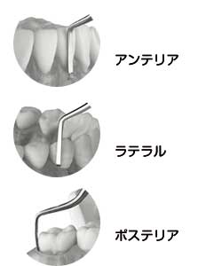 LMホースケーラー |