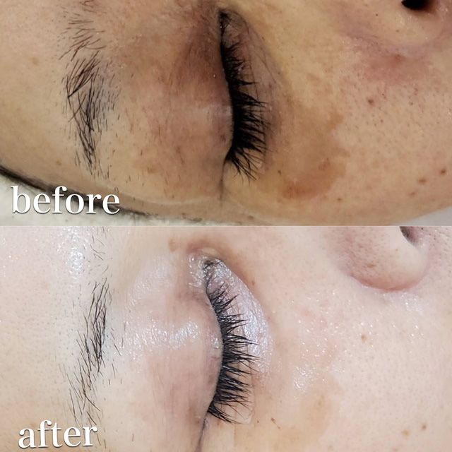 HERMOSA｜PURSUE エルモサハーブトリートメント