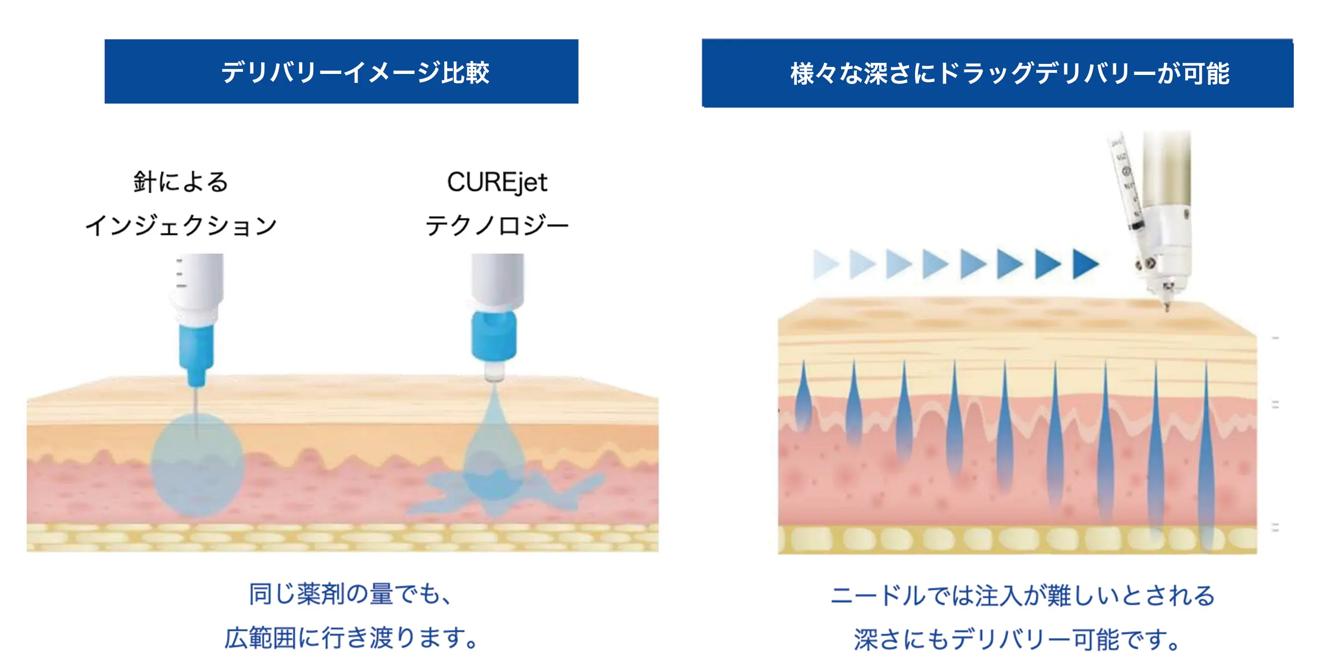 キュアジェットは立川駅北口 今井皮フ形成外科（東京都立川市）