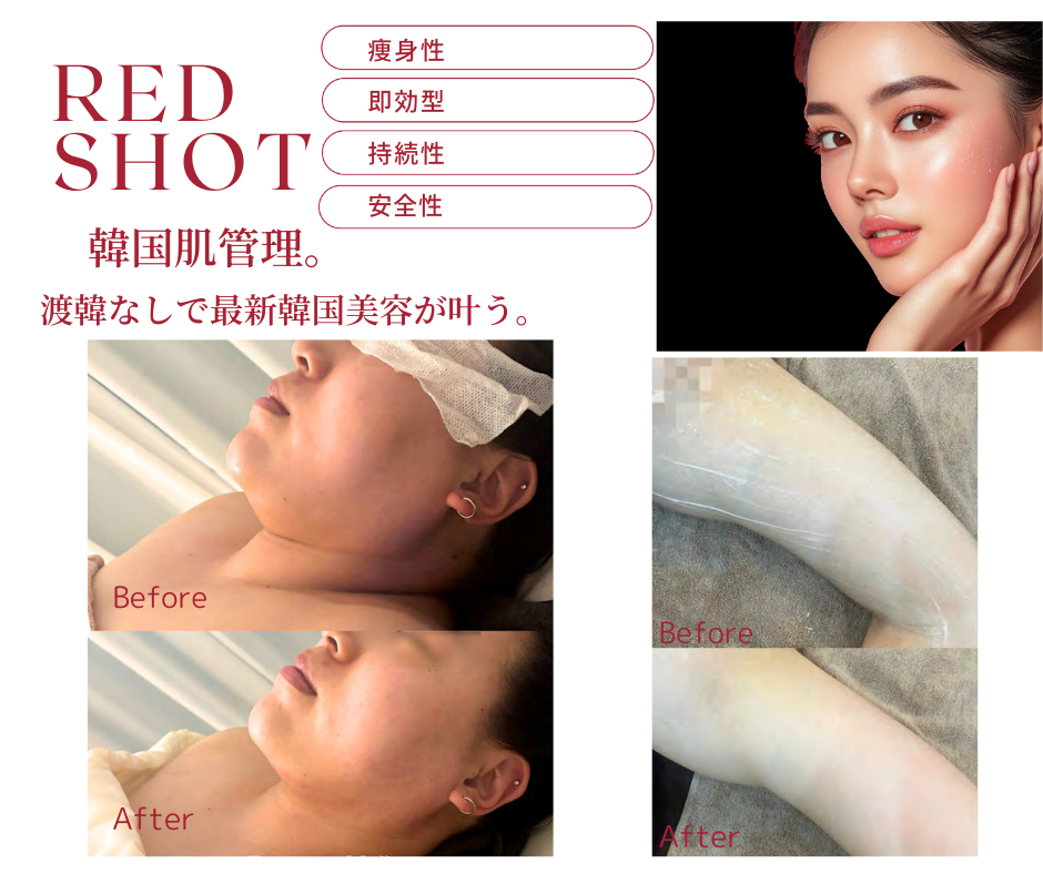 韓国脂肪溶解液レモンボトルの進化版？「レッドショット」ってレモン