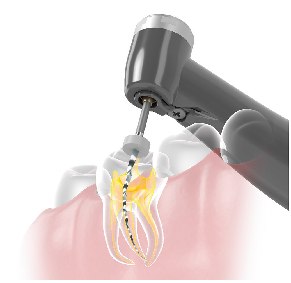 Tri Auto ZX2+ | MORITA
