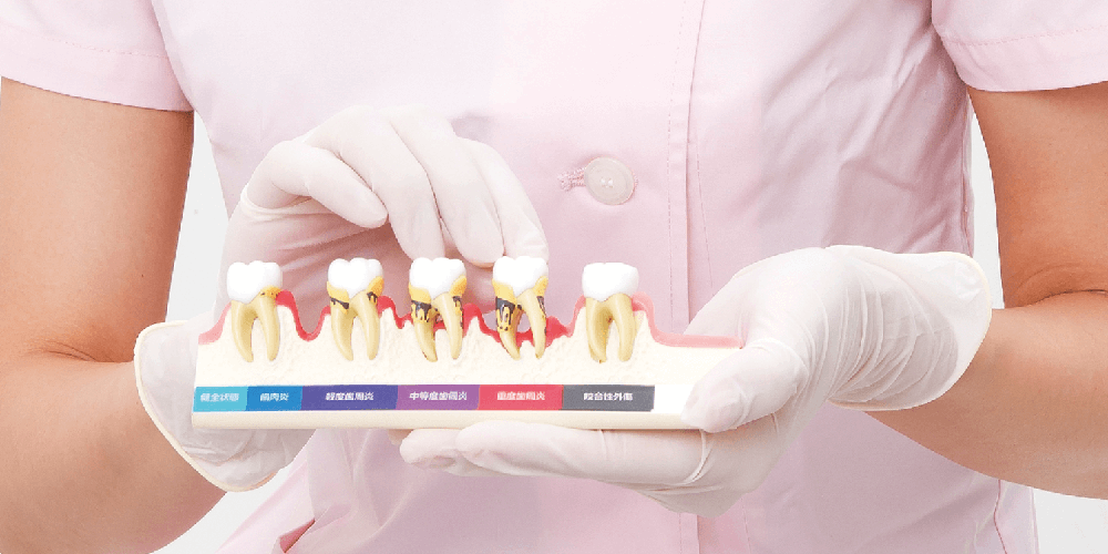 歯石セット｜株式会社ニッシン｜歯科模型・歯科材料のトップメーカー