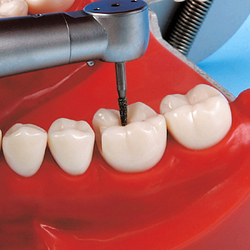 2色レジン製顎模型 [D51-500E](咬合器なし)｜株式会社ニッシン｜歯科