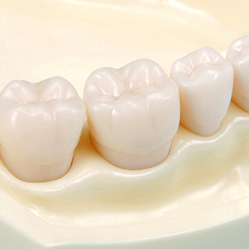 SRP用顎模型 [D16HD-500H(GSF)-MF](咬合器なし)｜株式会社ニッシン