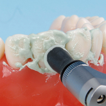 SRP用顎模型 [D18HD-500H(GUB)-MF](咬合器なし)｜株式会社ニッシン