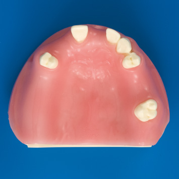 グラフト実習用顎模型 [P9-X.717]｜株式会社ニッシン｜歯科模型・歯科