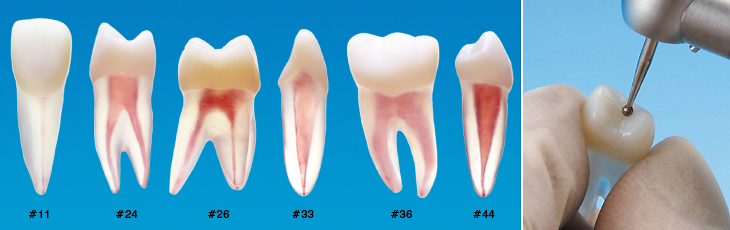 複製根髄腔模型歯 [B22Xシリーズ]｜株式会社ニッシン｜歯科模型・歯科