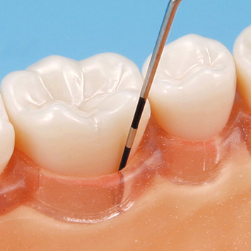 SRP用顎模型 [D16FE-500H(GSE)-MF](FE咬合器つき)｜株式会社ニッシン