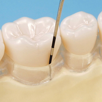 SRP用顎模型 [D16FE-500H(GSD)-MF](FE咬合器つき)｜株式会社ニッシン