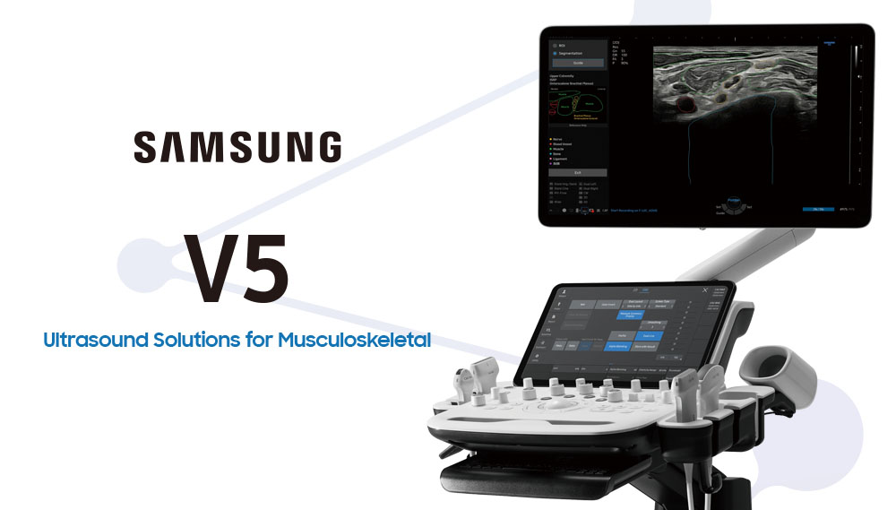 超音波画像診断装置 V5 System | 酒井医療株式会社