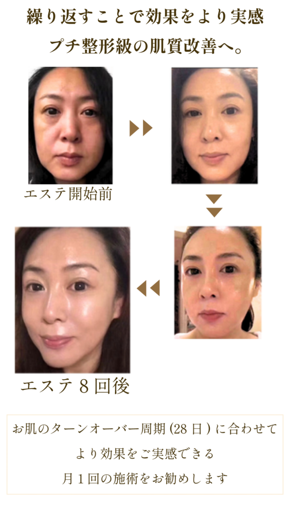 ルネセル化粧品の販売_20240523(旧) – Facial Salon Vihara