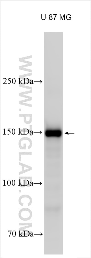 Collagen Type I antibody (14695-1-AP) | Proteintech