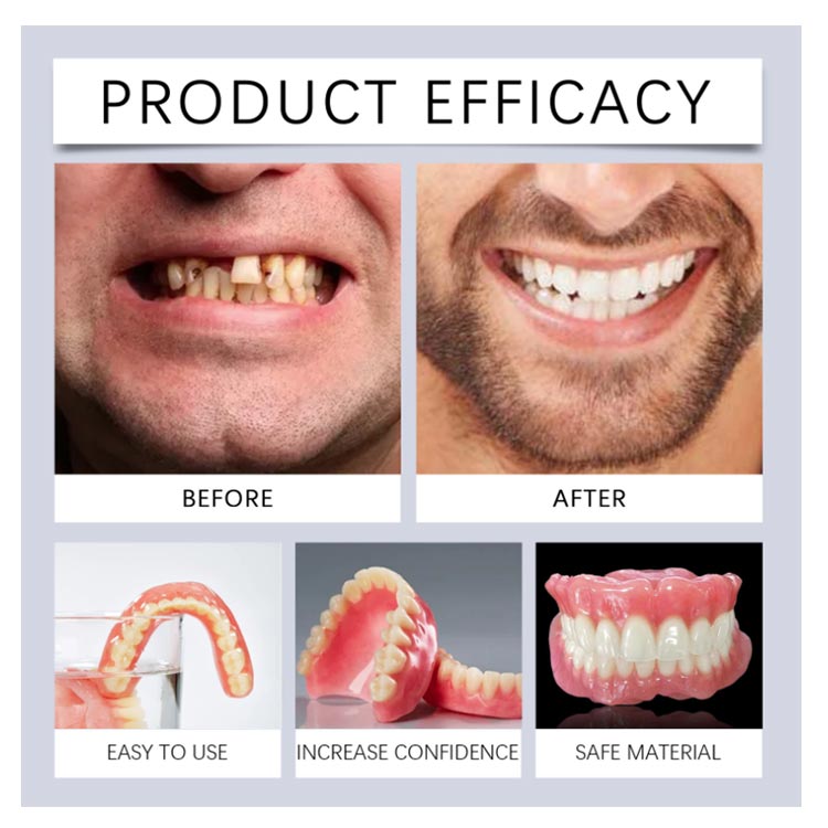 楽天市場】付け歯 レディース 上歯 下歯 仮歯 上下 上下セット 入れ歯