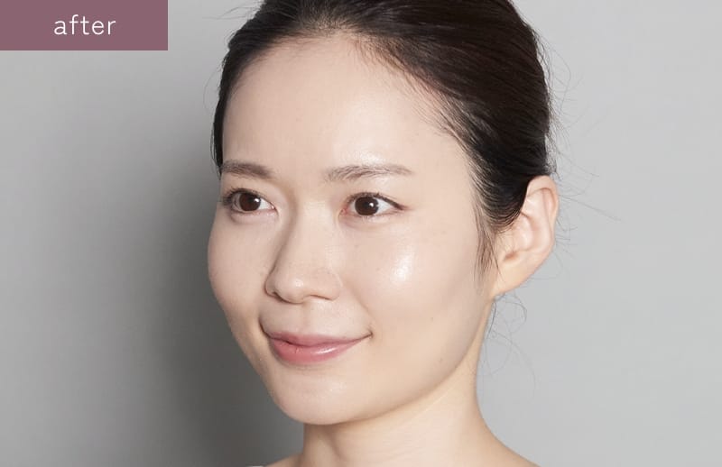 モイスチュアリフトファンデーション | rafuna