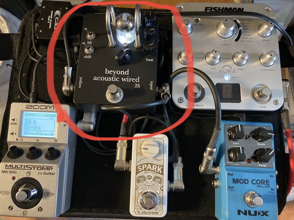 beyond acoustic wired 2S レビュー】森リーモ慎之介 さん | Things Blog