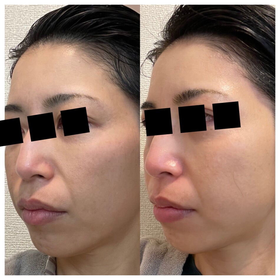 2025ベストコスメ受賞】エンビロン スーパーモイスチャーライザー