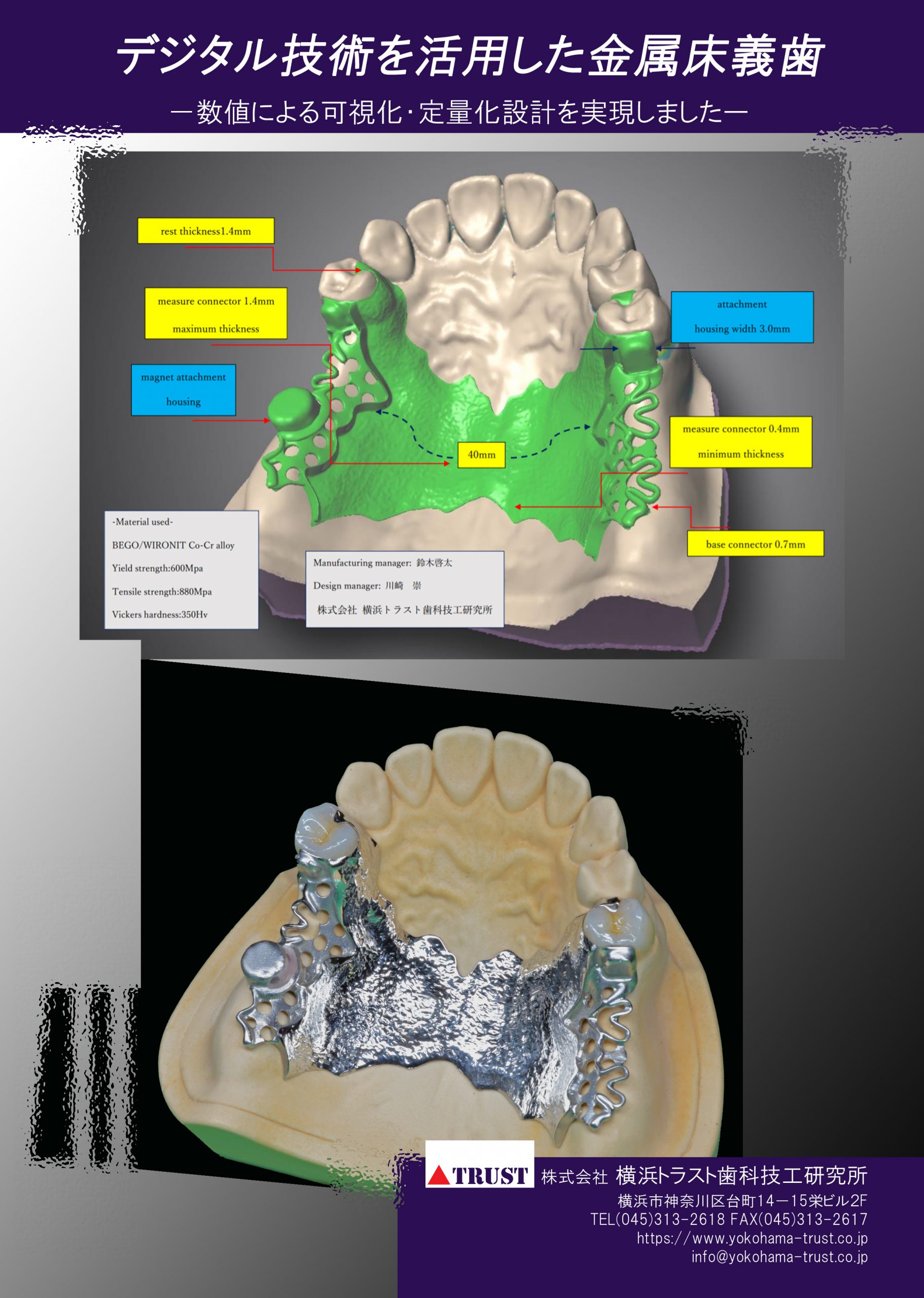 デジタル金属床義歯のパンフレットを作成しました - 横浜トラスト歯科