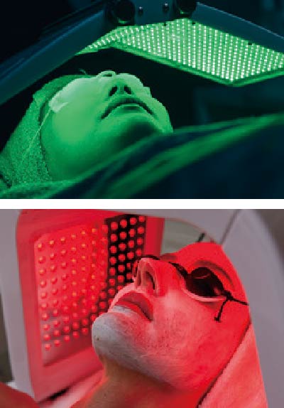 フォトプラス EX | YA-MAN TOKYO JAPAN | ヤーマン株式会社