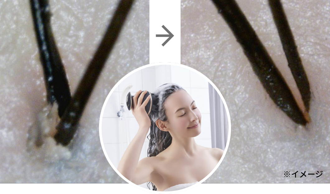 ヴェーダリフト｜YA-MAN PROFESSIONAL (ヤーマン プロフェッショナル