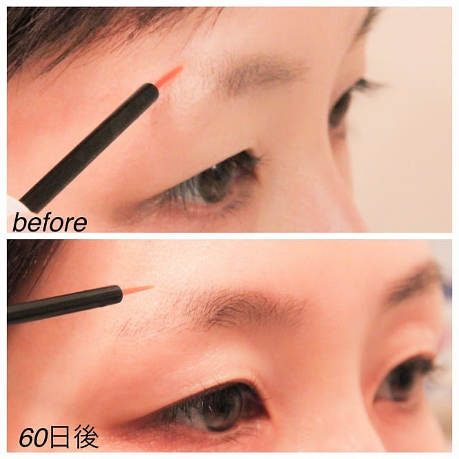 正規品保証】ブロウアディクト｜新規会員登録で500pt付与＆購入で10％還元