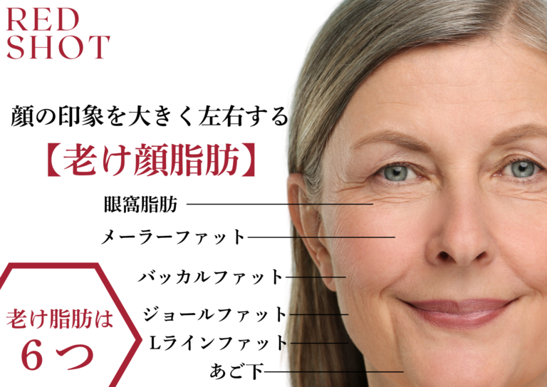 韓国発【RED SHOT 完全ガイド】脂肪溶解レッドショットとは？成分