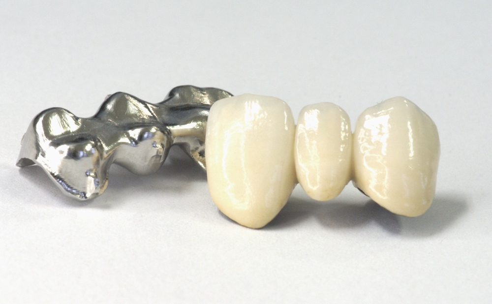 メタルボンド チタンボンド - 株式会社足利セラミックラボラトリー