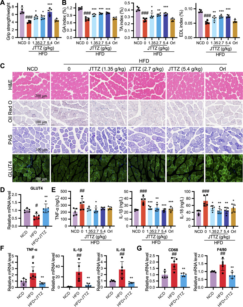 Jiangtang Tiaozhi formula improves obesity and insulin resistance