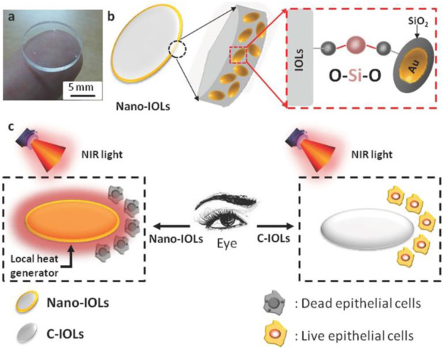 Smart nano-micro platforms for ophthalmological applications: The