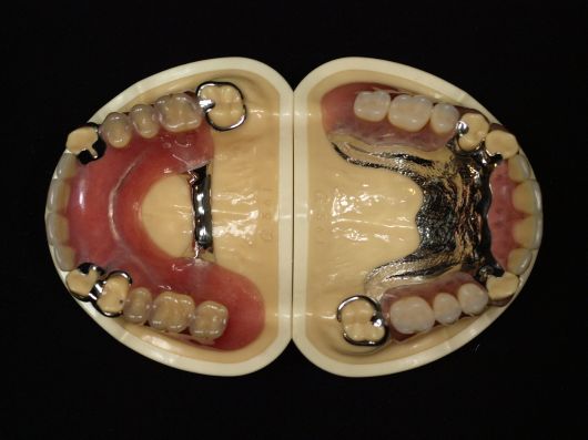 有床義歯説明用 – 【公式】広島市の歯科技工所「株式会社アート