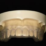 患者様説明用模型 – 【公式】広島市の歯科技工所「株式会社アート