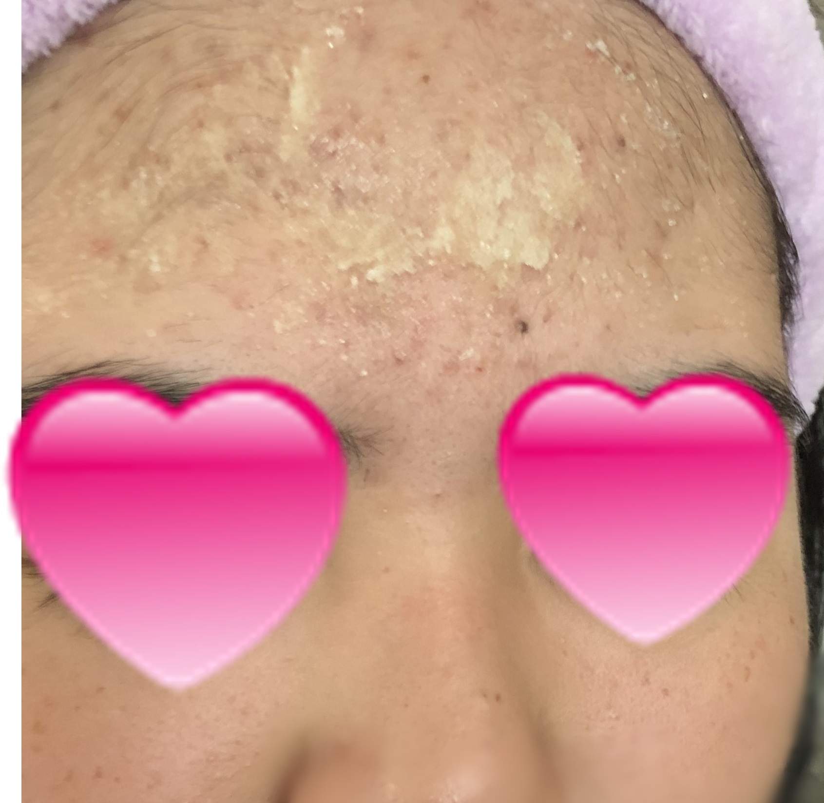 肌断食研究所】口コミ｜美塩の塩洗顔で肌断食してみた！ – Otona 美容