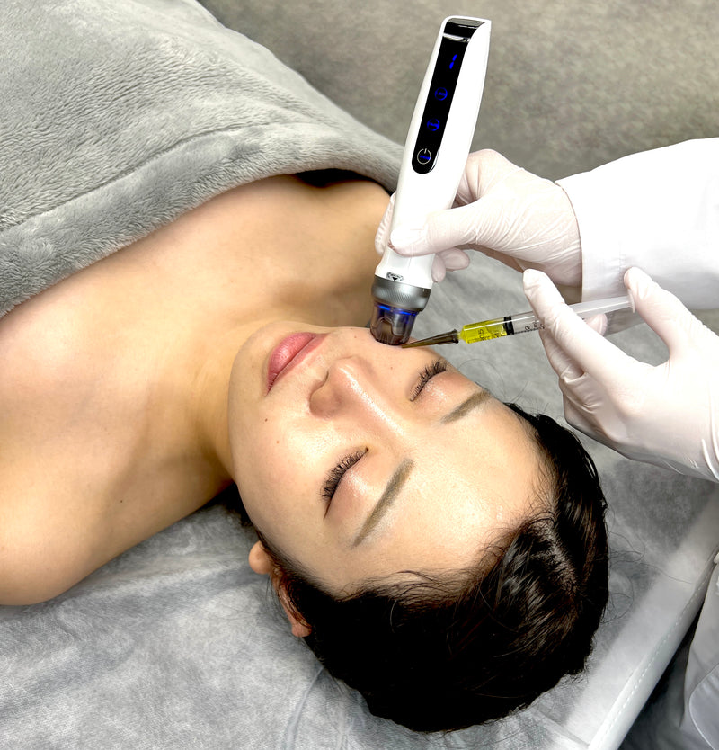 1本だけお試し] レモンボトル (10ml×1バイアル)(脂肪分解剤)