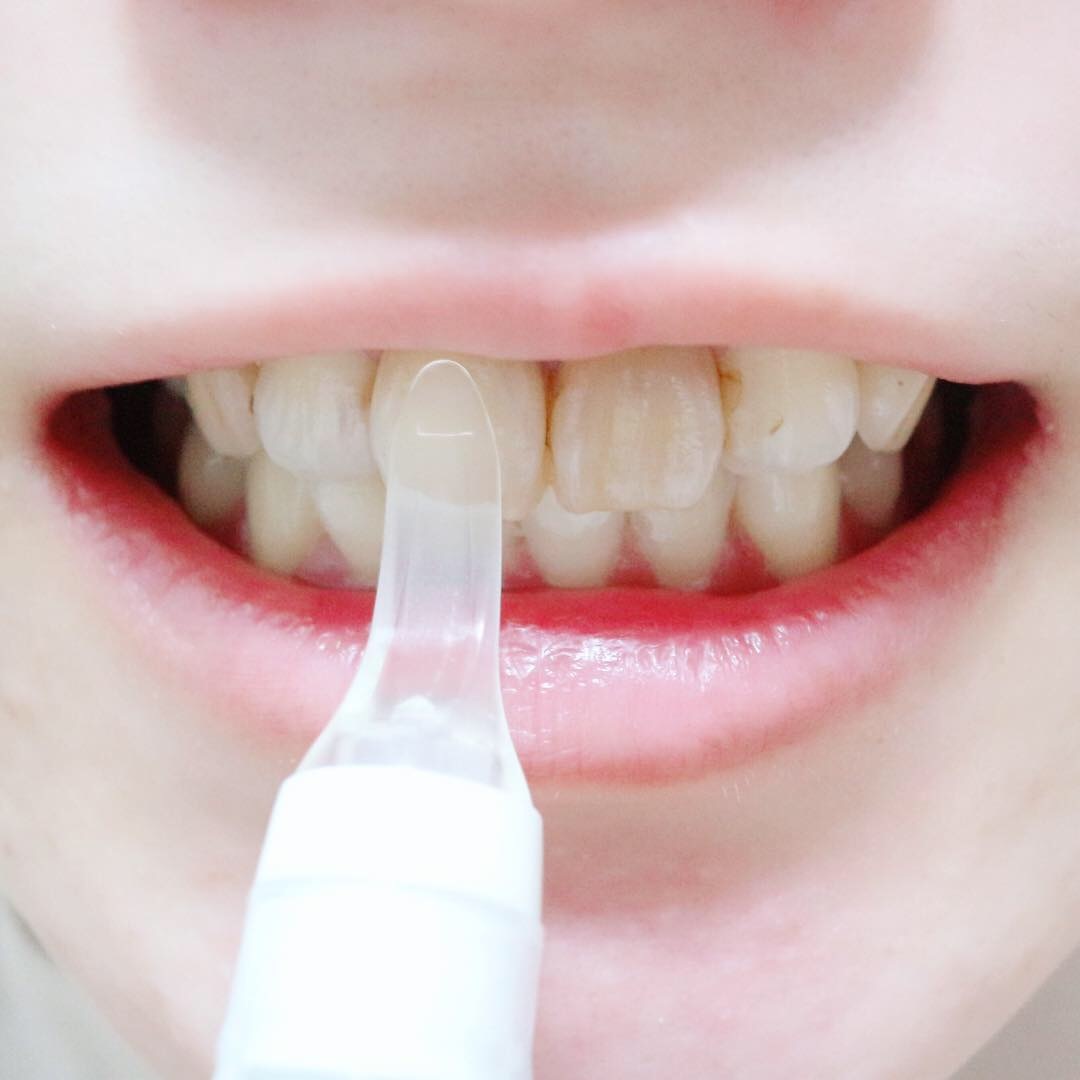 シャイニープラス / 薬用プレミアムホワイトの公式商品情報｜美容