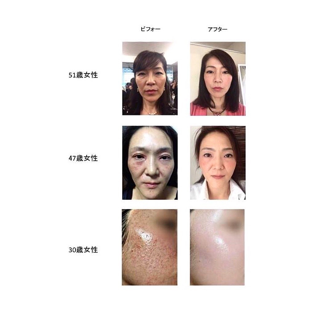 ルビーセル / インテンシブ4Uアンプルの商品情報｜美容・化粧品情報は