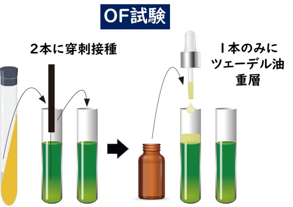 グラム陰性菌の整理に必要なOF試験判定 | 食品微生物学（検査と制御