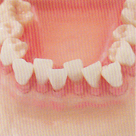 製品詳細「SRP実習用顎模型 P15FE-MINT.1」 | フォルディネット