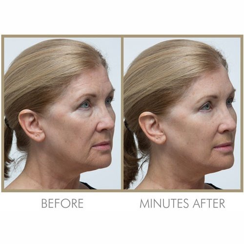 Instant Line Smoother, 19ml & 30ml – Genie Beauty Products